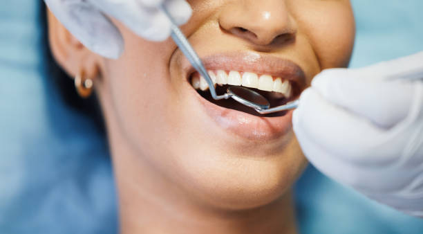 Best Broken or Cracked Tooth Emergency Dentist in Springdale, OH